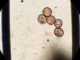 Attēlu rezultāti vaicājumam “Physarum leucophaeum sessile”