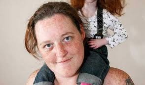 Image result for Nanismo Primordial