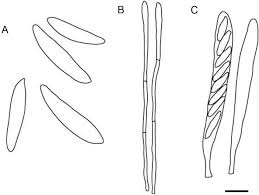 Attēlu rezultāti vaicājumam “Cudoniella acicularis”