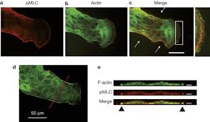 Attēlu rezultāti vaicājumam “Leiocolea rutheana cells”