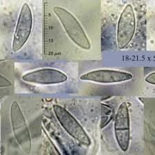Attēlu rezultāti vaicājumam “Cudoniella acicularis”