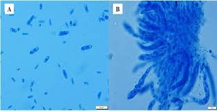 Attēlu rezultāti vaicājumam “Didymium bahiense spores”