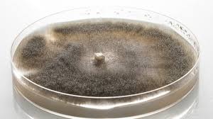 Attēlu rezultāti vaicājumam “Trichia botrytis var. cerifera spores”