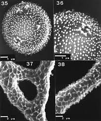 Attēlu rezultāti vaicājumam “Arcyria affinis spores”