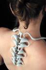 Molly Epstein. "Vertebrae"