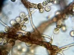 Attēlu rezultāti vaicājumam “Cribraria aurantiaca spores”