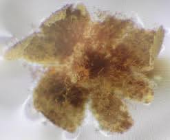 Attēlu rezultāti vaicājumam “Physarum viride var. aurantium stalked”