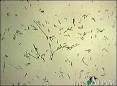 Campylobacter serology test - Scripps Health - San Diego