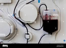 Image result for Autopheresis C