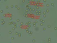 Attēlu rezultāti vaicājumam “Arcyria incarnata”