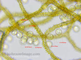 Attēlu rezultāti vaicājumam “Heterotrichia obvelata (syn. Arcyria obvelata) spores”