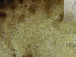 Attēlu rezultāti vaicājumam “Plectocarpon lichenum”