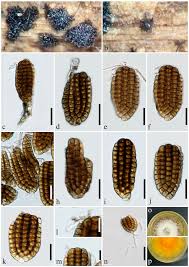 Attēlu rezultāti vaicājumam “Diachea dictyospora (syn. Craterium dictyosporum) spores”