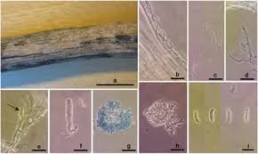 Attēlu rezultāti vaicājumam “Enteridium corticatum spores”