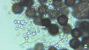 Attēlu rezultāti vaicājumam “Lycogala cf. oleocrystalliferum macro”