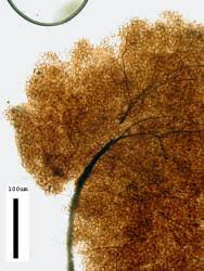 Attēlu rezultāti vaicājumam “Comatricha elegans stalked”