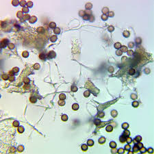 Attēlu rezultāti vaicājumam “Physarum braunianum plasmodium”