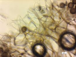 Attēlu rezultāti vaicājumam “Lamproderma echinosporum macro”