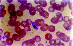 Attēlu rezultāti vaicājumam “Oligonema favogineum plasmodium”