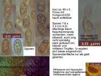 Attēlu rezultāti vaicājumam “Nectria episphaeria”