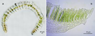 Attēlu rezultāti vaicājumam “Jungermannia hyalina cells”