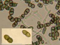 Attēlu rezultāti vaicājumam “Calicium salicinum”