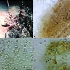 Attēlu rezultāti vaicājumam “Arcyria affinis spores”