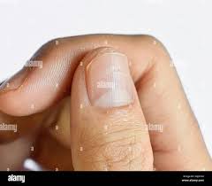 Image result for lunula nail