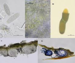 Attēlu rezultāti vaicājumam “Pertusaria leioplaca”