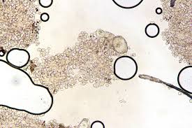 Attēlu rezultāti vaicājumam “Erythricium aurantiacum”
