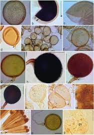 Attēlu rezultāti vaicājumam “Stemonaria irregularis spores”