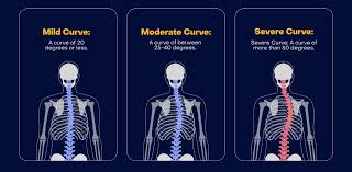 Image result for Curves