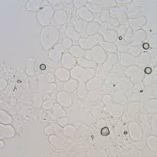 Attēlu rezultāti vaicājumam “Erythricium aurantiacum”