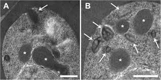 Attēlu rezultāti vaicājumam “Enteridium variabile plasmodium”