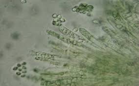 Attēlu rezultāti vaicājumam “Ombrophila violacea spores”