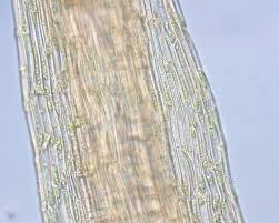 Attēlu rezultāti vaicājumam “Leptobryum pyriforme sporophyte”