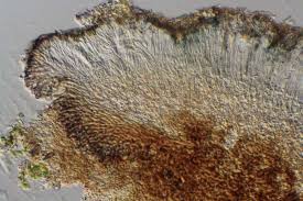 Attēlu rezultāti vaicājumam “Lecidella elaeochroma”