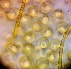 Attēlu rezultāti vaicājumam “Lycogala ustulatum macro”