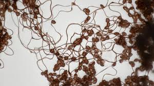 Attēlu rezultāti vaicājumam “Comatricha alta”