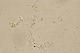 Attēlu rezultāti vaicājumam “Orbilia sp.”