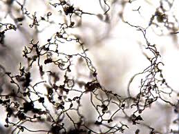 Attēlu rezultāti vaicājumam “Stemonitopsis typhina spores”