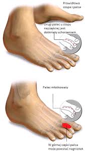 Znalezione obrazy dla zapytania palec