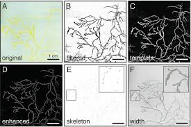 Attēlu rezultāti vaicājumam “Physarum penetrale stalked”