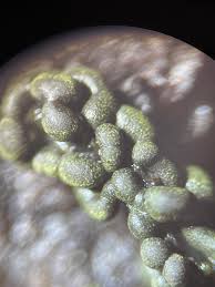 Attēlu rezultāti vaicājumam “Physarum virescens”