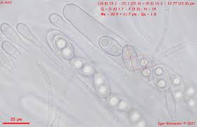 Attēlu rezultāti vaicājumam “Humaria hemisphaerica”