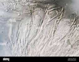 Attēlu rezultāti vaicājumam “Scoliciosporum chlorococcum”