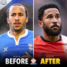 Image result for Liverpool Transplant FC