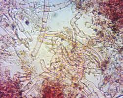 Attēlu rezultāti vaicājumam “Ceriporia excelsa”