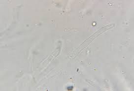 Attēlu rezultāti vaicājumam “Ombrophila violacea spores”