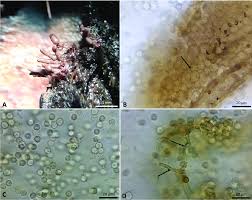 Attēlu rezultāti vaicājumam “Arcyria affinis”